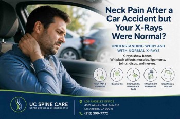 Neck Pain After a Car Accident but Your X-Rays Were Normal?