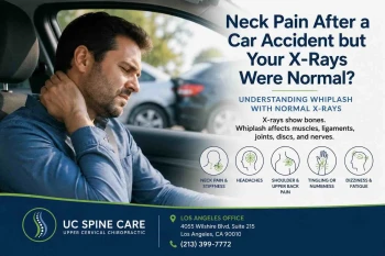 Neck Pain After a Car Accident but Your X-Rays Were Normal?